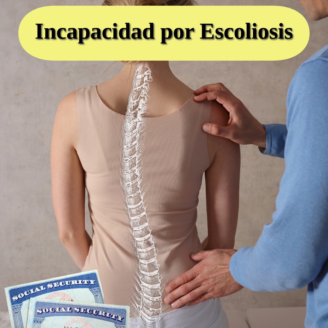 Incapacidad por Escoliosis Seguro Social